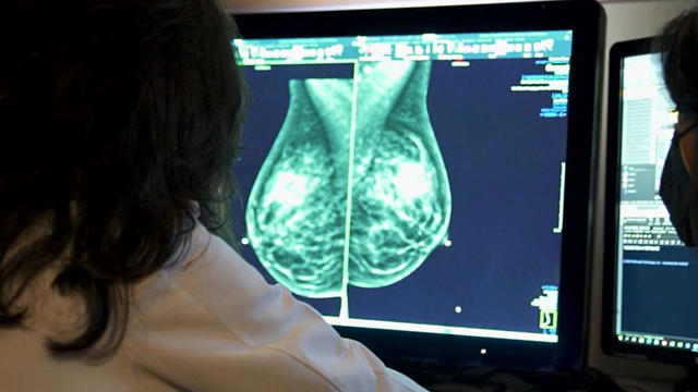 breast-cancer-check.jpg 